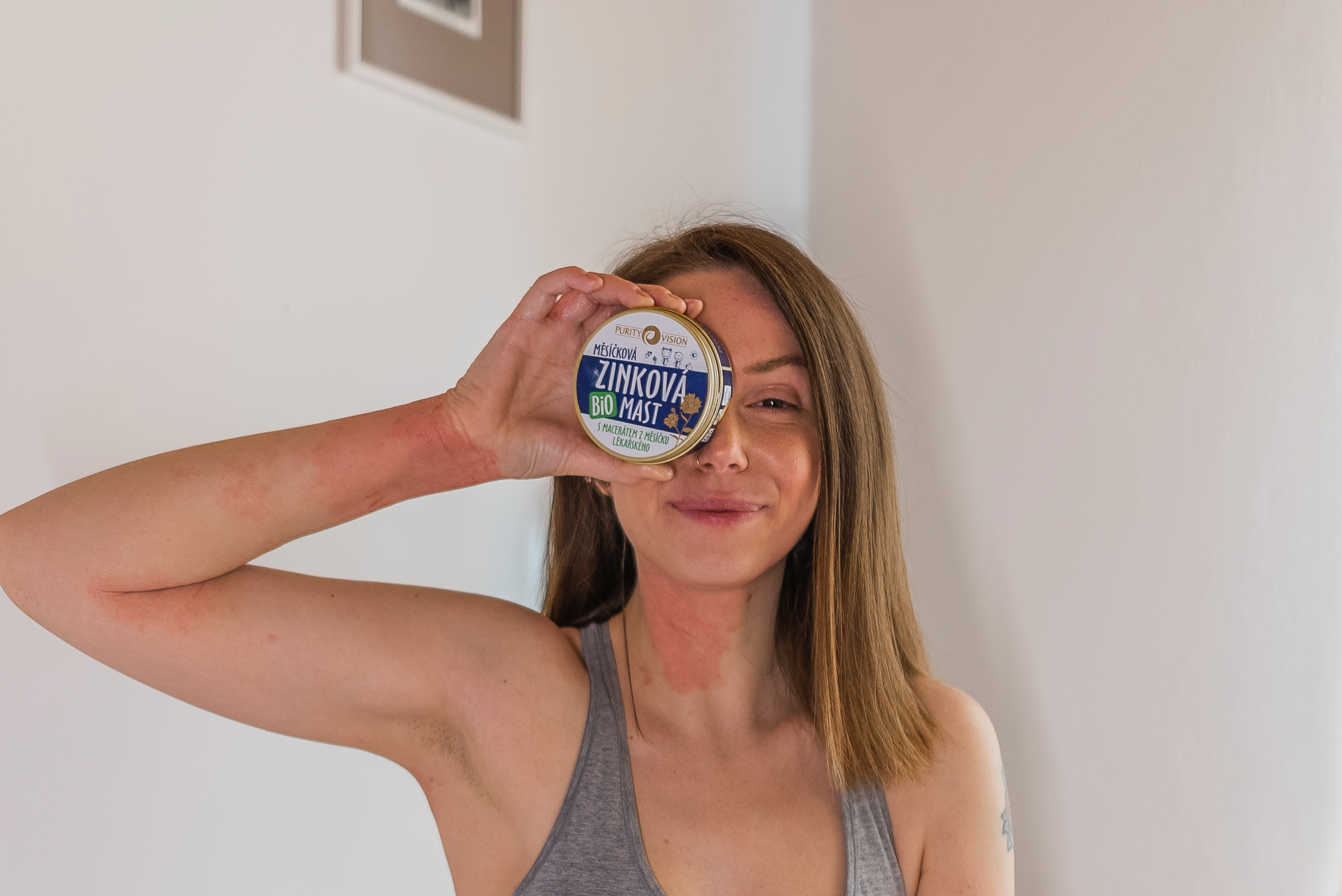 Skin Care for Eczema‑Prone Skin
